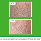 O’Keeffe’s Working Hands Hand & Body Lotion – hydratačný krém na ruky a telo pre suchú a popraskanú pokožku, 315 ml