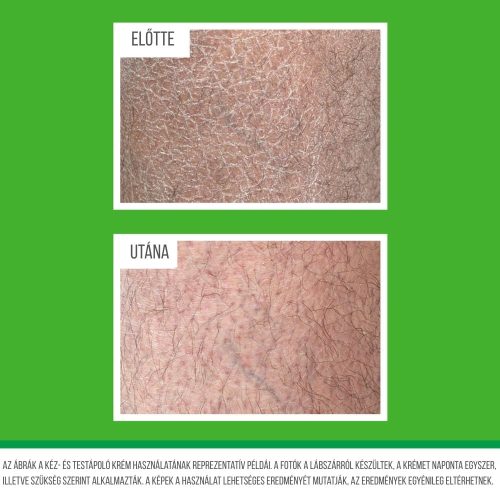 O’Keeffe’s Working Hands Hand & Body Lotion – hydratačný krém na ruky a telo pre suchú a popraskanú pokožku, 315 ml