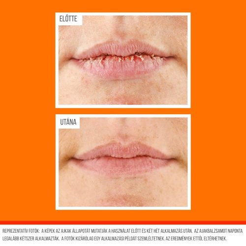 O’Keeffe’s Lip Repair Overnight nočný regeneračný balzam na pery – 7 g