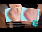 O'Keeffe's for Healthy Feet Tube krém na nohy 60g