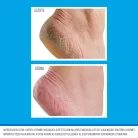 O'Keeffe's for Healthy Feet EXFOLIATING Tube exfoliačný a hydratačný krém na nohy 80ml