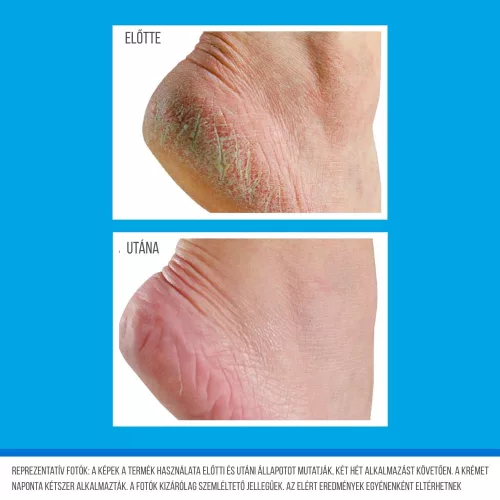 O'Keeffe's for Healthy Feet EXFOLIATING Tube exfoliačný a hydratačný krém na nohy 80ml